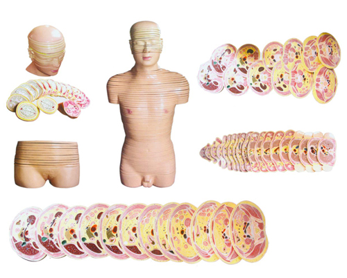 ���w�^���|�əM�����ӽ���ģ��