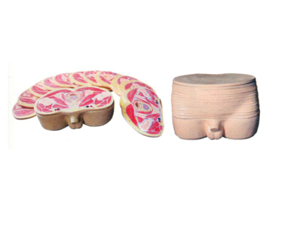 �����貿�M�����ӽ���ģ��